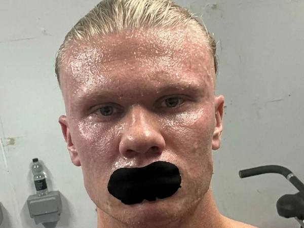 Erling Haaland y el “mouth taping”: riesgos y qué recomiendan
